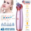 Electric Blackhead Remover Vacuum Suction Facial Pore Cleaner Acne Pimple Extractor Skin Care Cleaning Tool with 5 Suction Head